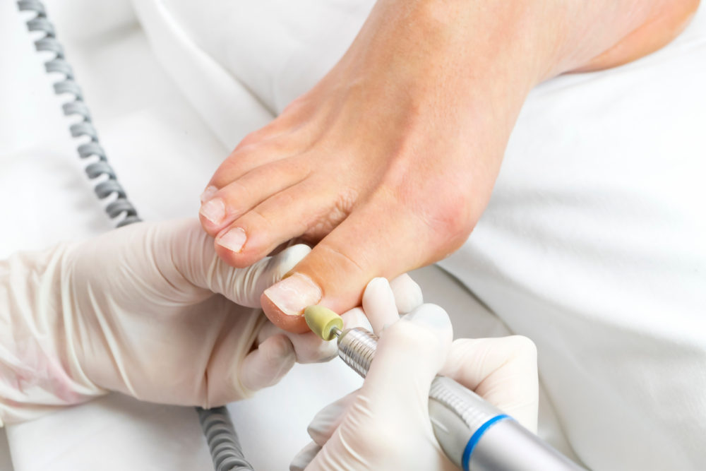 Soins de pédicure médicale